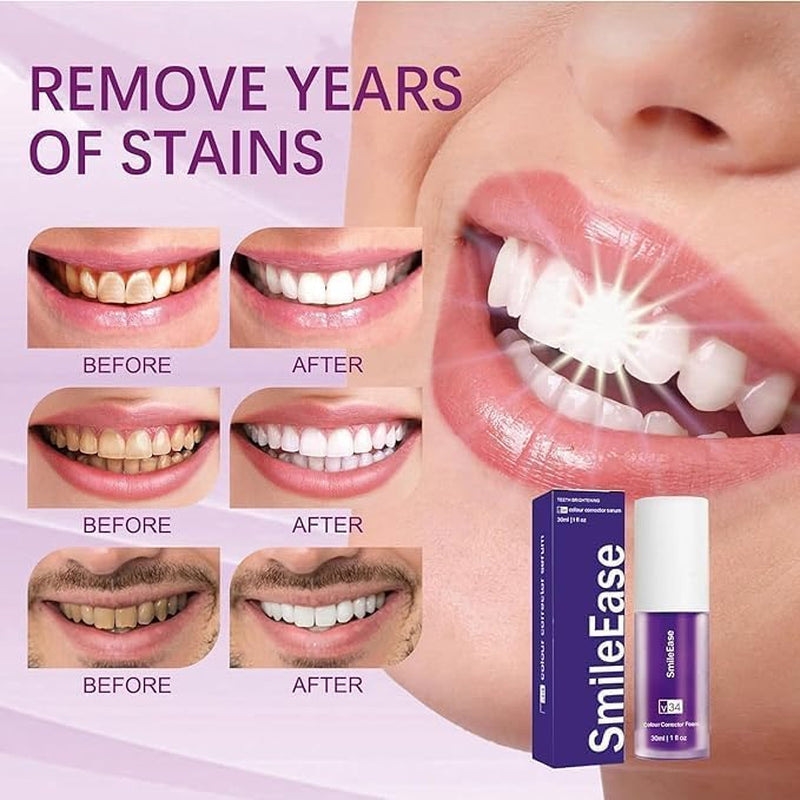 Purple Teeth Whitening