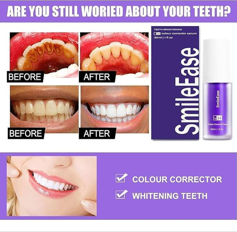 Purple Teeth Whitening